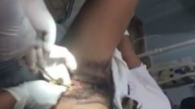 Mulher de Traficante Tentou Entrar na Prisão Com Muita Droga Enfiada na Buceta Mas ao Ser Flagrada Teve Que Extrair Tudo no Hospital – Caiu na Net
